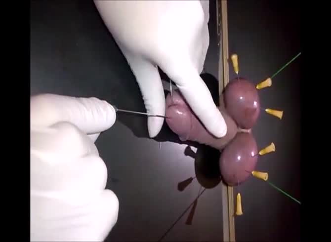 Video :Poor swollen cock got nipped by long thin needles 